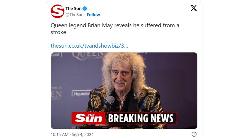 Брайън Мей от Queen е получил инсулт